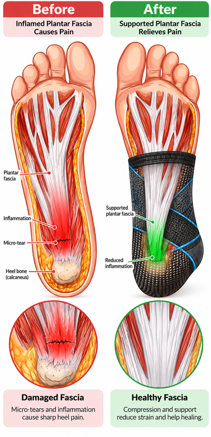 Avelzaa foot sleeve – Comfortable Foot Support